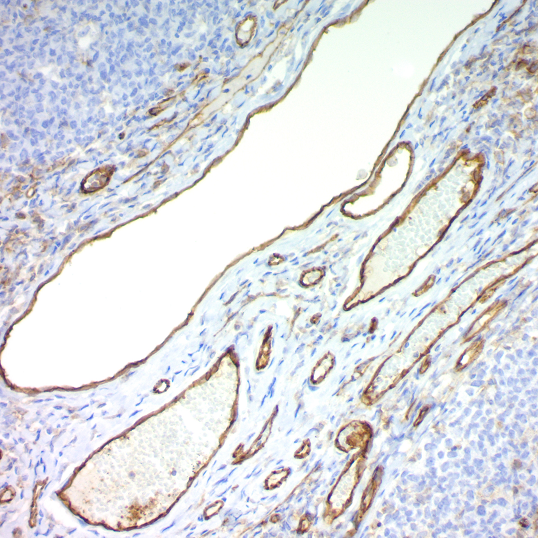 CD31, Endothelial Cell; Clone JC/70A (Ready-To-Use)